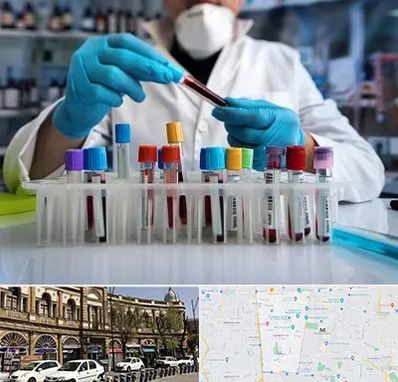 آزمایشگاه خون در منطقه 11 تهران