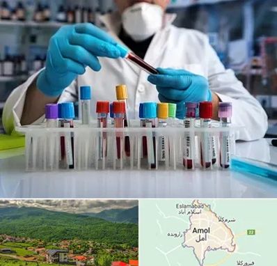 آزمایشگاه خون در آمل