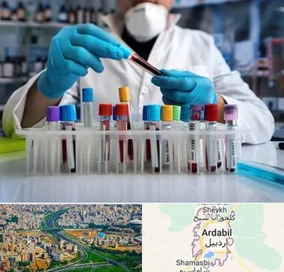 آزمایشگاه خون در اردبیل