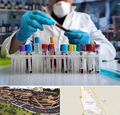 آزمایشگاه خون در شاهین شهر