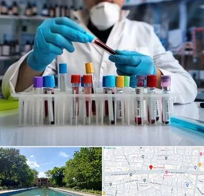 آزمایشگاه خون در هشت بهشت اصفهان