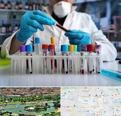 آزمایشگاه خون در منطقه 9 تهران