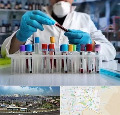 آزمایشگاه خون در منطقه 15 تهران