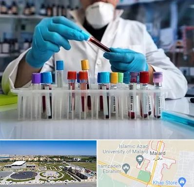 آزمایشگاه خون در ملارد