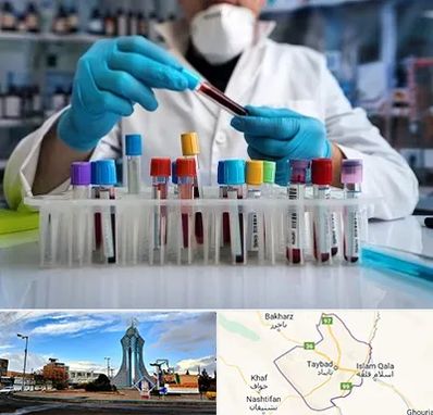 آزمایشگاه خون در تایباد