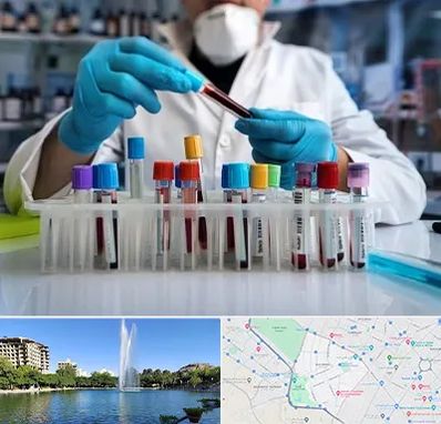 آزمایشگاه خون در کوهسنگی مشهد