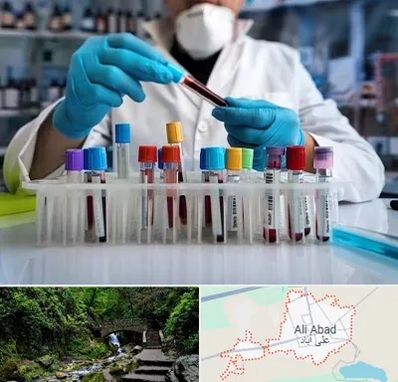 آزمایشگاه خون در علی آباد کتول