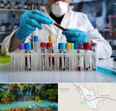 آزمایشگاه خون در دورود