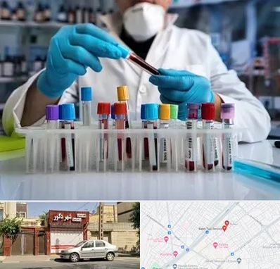 آزمایشگاه خون در باجک قم