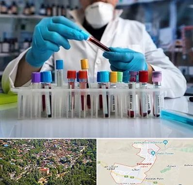 آزمایشگاه خون در دماوند