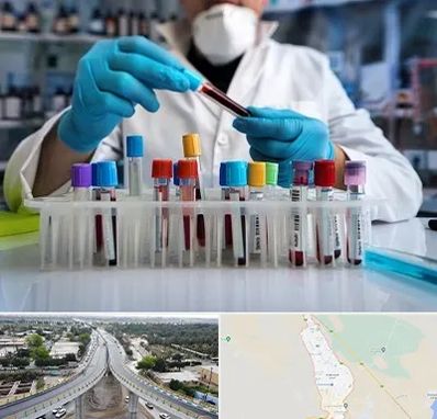 آزمایشگاه خون در اندیمشک