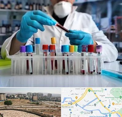 آزمایشگاه خون در کوی وحدت شیراز