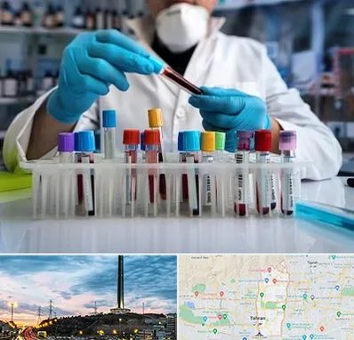 آزمایشگاه خون در منطقه 2 تهران