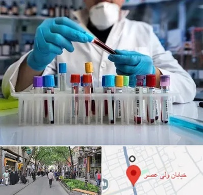 آزمایشگاه خون در ولیعصر شهریار