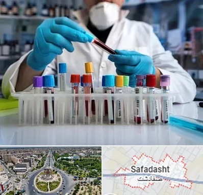 آزمایشگاه خون در صفادشت