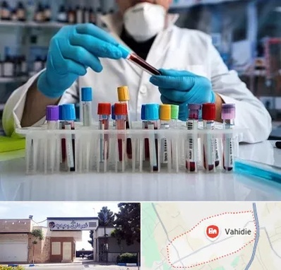 آزمایشگاه خون در وحیدیه شهریار