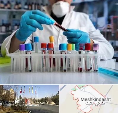 آزمایشگاه خون در مشکین دشت