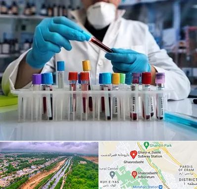 آزمایشگاه خون در قصرالدشت شیراز