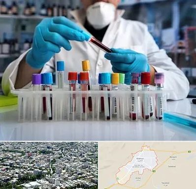 آزمایشگاه خون در شاهرود