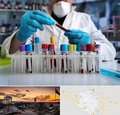 آزمایشگاه خون در قوچان
