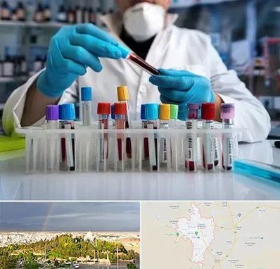 آزمایشگاه خون در تربت حیدریه