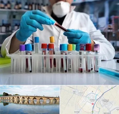 آزمایشگاه خون در فلاورجان