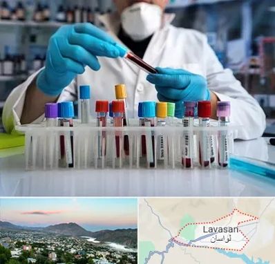 آزمایشگاه خون در لواسان