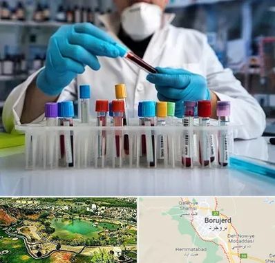 آزمایشگاه خون در بروجرد