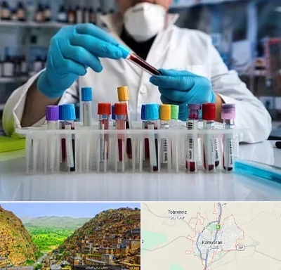 آزمایشگاه خون در کامیاران