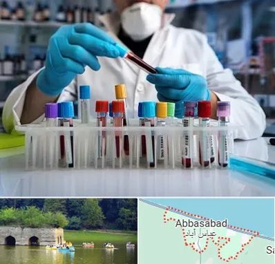 آزمایشگاه خون در عباس آباد