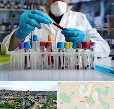 آزمایشگاه خون در شهریار