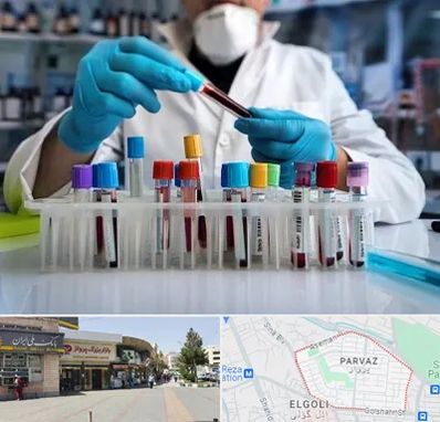 آزمایشگاه خون در پرواز تبریز