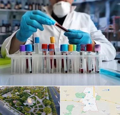 آزمایشگاه خون در کاشمر