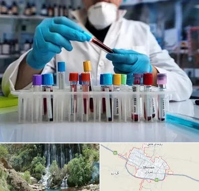 آزمایشگاه خون در شیروان