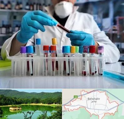 آزمایشگاه خون در بهشهر
