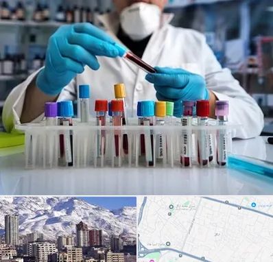 آزمایشگاه خون در ازگل