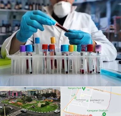 آزمایشگاه خون در تهرانسر
