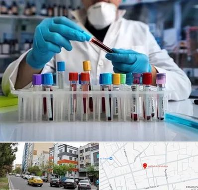 آزمایشگاه خون در هفده شهریور تبریز