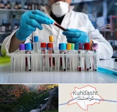 آزمایشگاه خون در کوهدشت