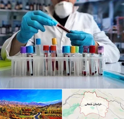 آزمایشگاه خون در خراسان شمالی
