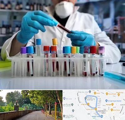 آزمایشگاه خون در فلکه گاز رشت