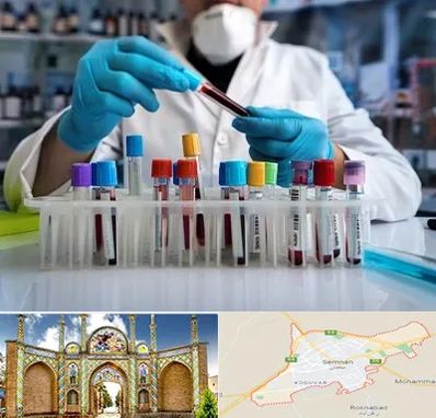 آزمایشگاه خون در سمنان