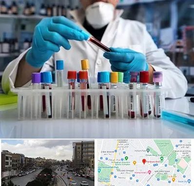 آزمایشگاه خون در بلوار فردوسی مشهد