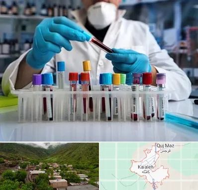 آزمایشگاه خون در کلاله
