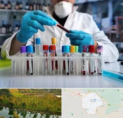 آزمایشگاه خون در بهبهان