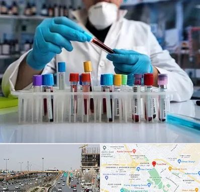 آزمایشگاه خون در بلوار توس مشهد