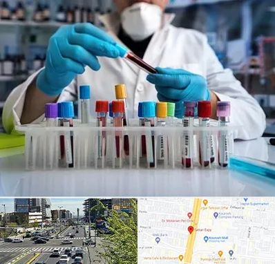 آزمایشگاه خون در ستاری