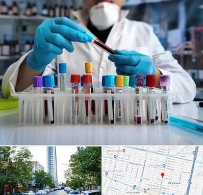 آزمایشگاه خون در امامت مشهد