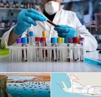 آزمایشگاه خون در چابهار