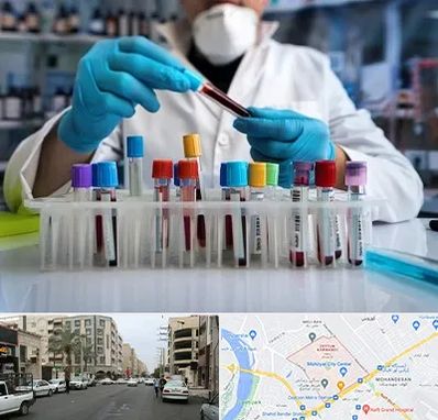 آزمایشگاه خون در زیتون کارمندی اهواز